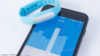 Smartwatch Xiaomi Kalahkan Apple
